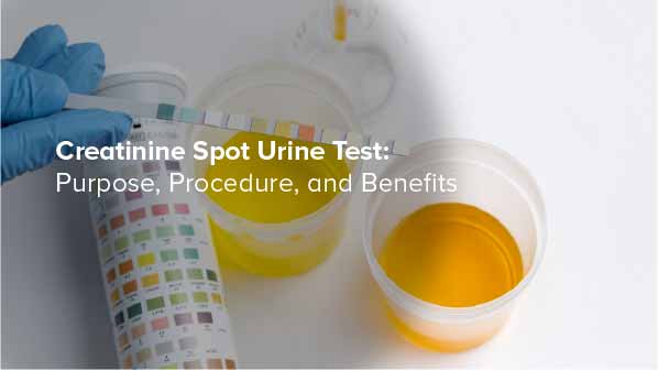 Creatinine Spot Urine Test: Purpose, Procedure, and Benefits